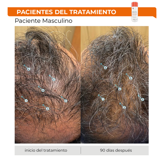 Revita® 205ML | Shampoo Estimulante para la Densidad Capilar