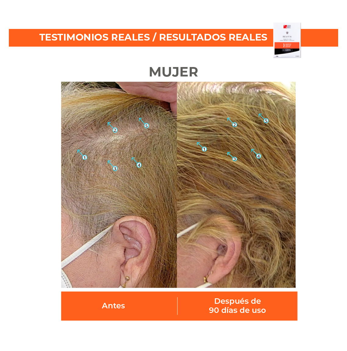 REVITA® | Tabletas