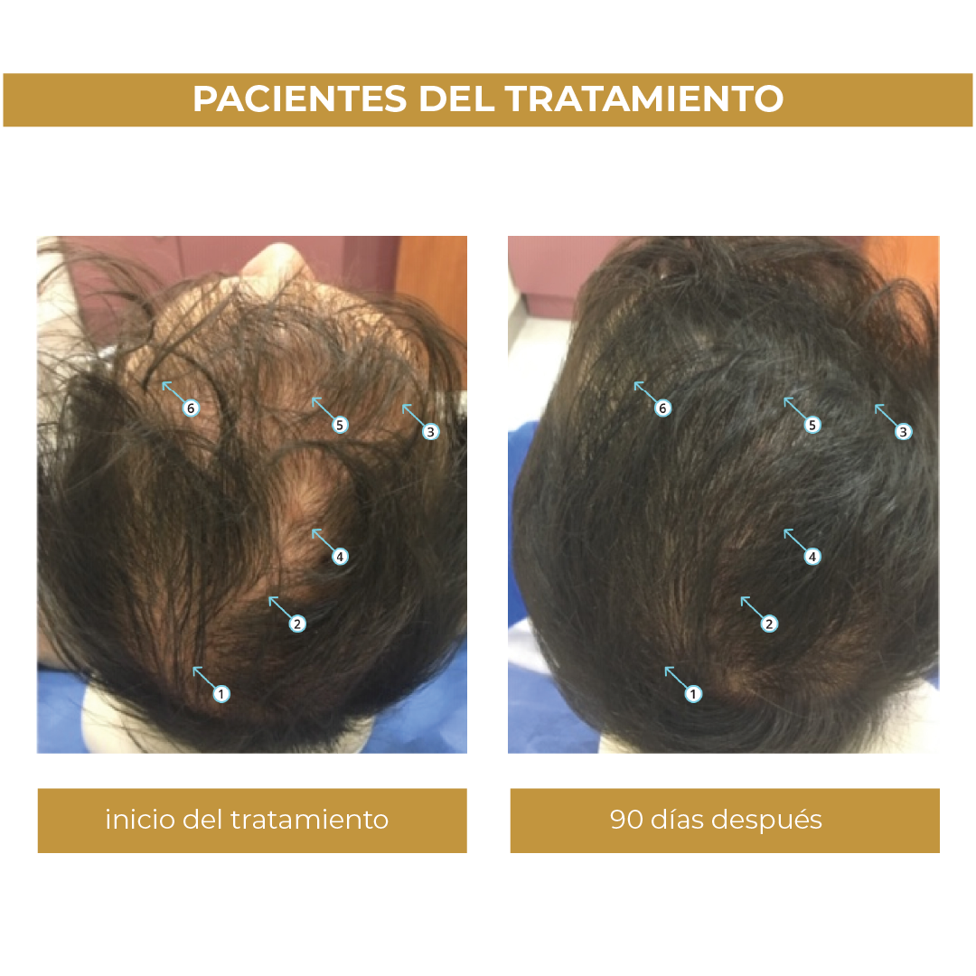 Spectral.Men's® | Loción Capilar