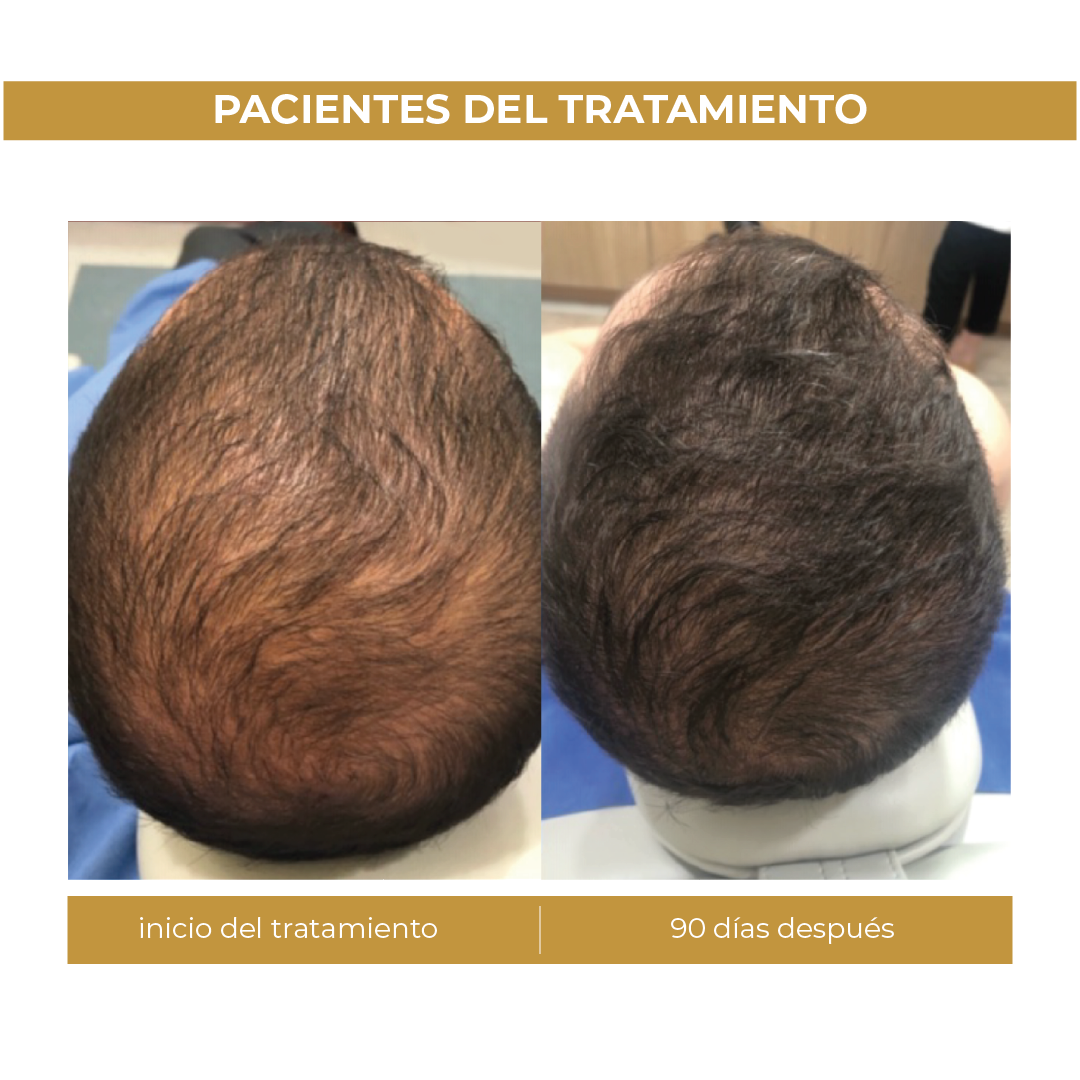 Spectral.Men's® | Loción Capilar