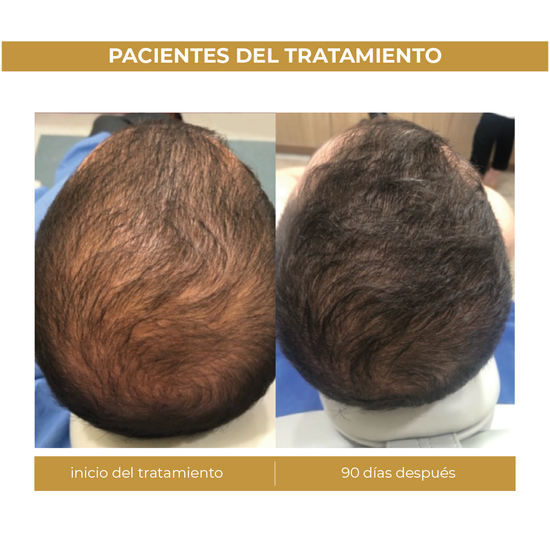 Spectral.Men's® | Loción Capilar